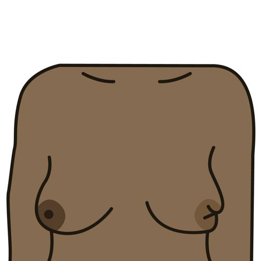 A nipple change, for example it has become pulled in (inverted) 