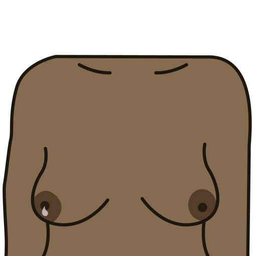 Unusual liquid (discharge) from either nipple