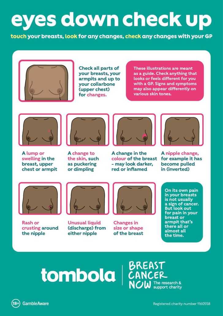 Breast Cancer Now infographic