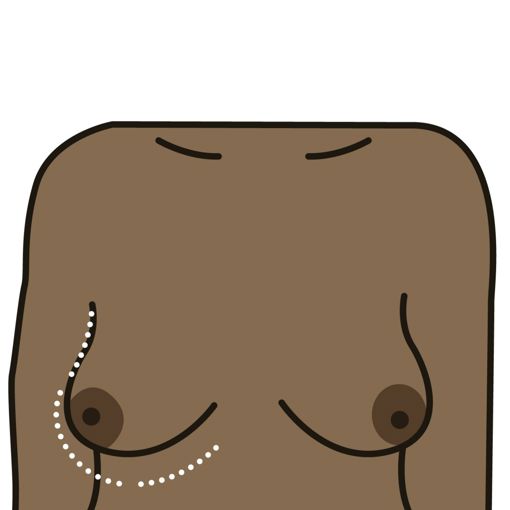 Changes in size or shape